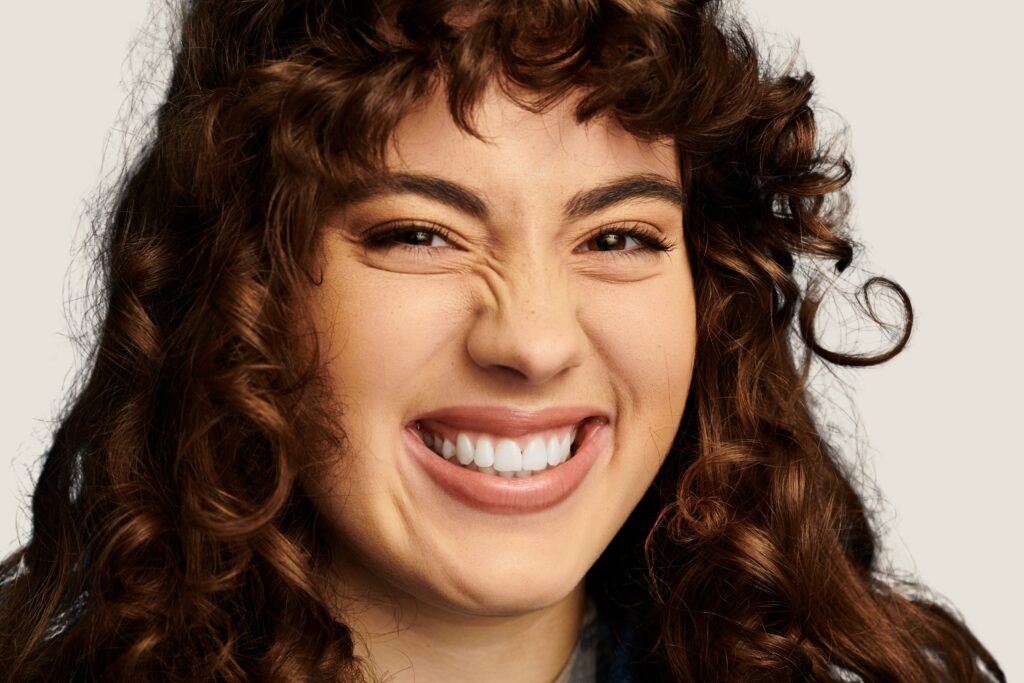 Sonrisa gingival